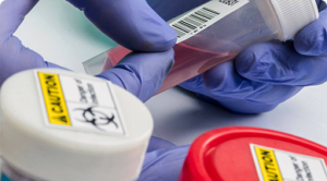 Drug and Alcohol Tests